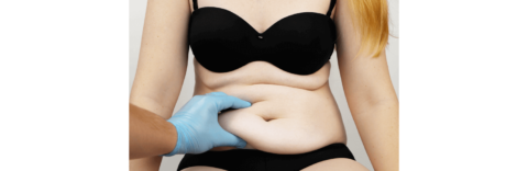 How to get better tummy tuck results?