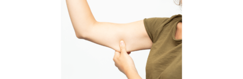 When should I consider an arm lift procedure?